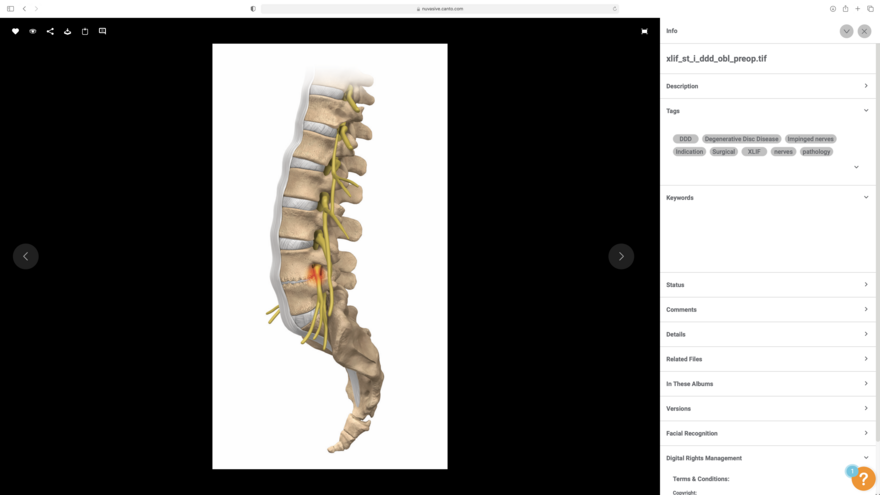 Screenshot of a digital asset in a digital asset management system, showing keywords, tags and a diagram of a spinal column.