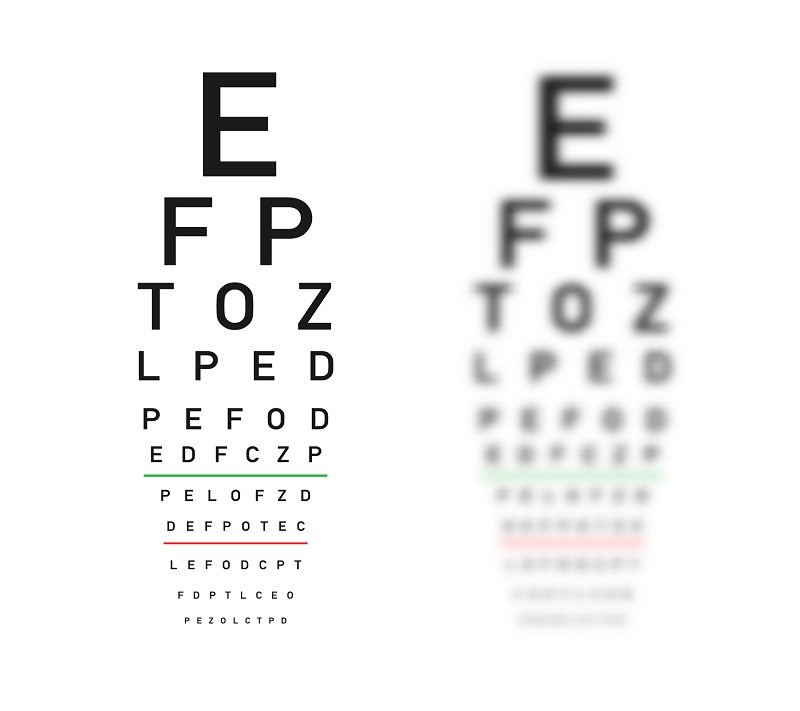 A picture of an eye exam example.